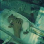 Picture of James in the incubator with his mother's hand over him.